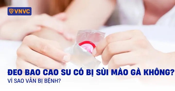 Mang Bao Cao Su Có Dính Bầu Không