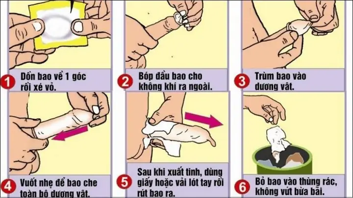 Mang Bao Cao Su Vẫn Có Thai