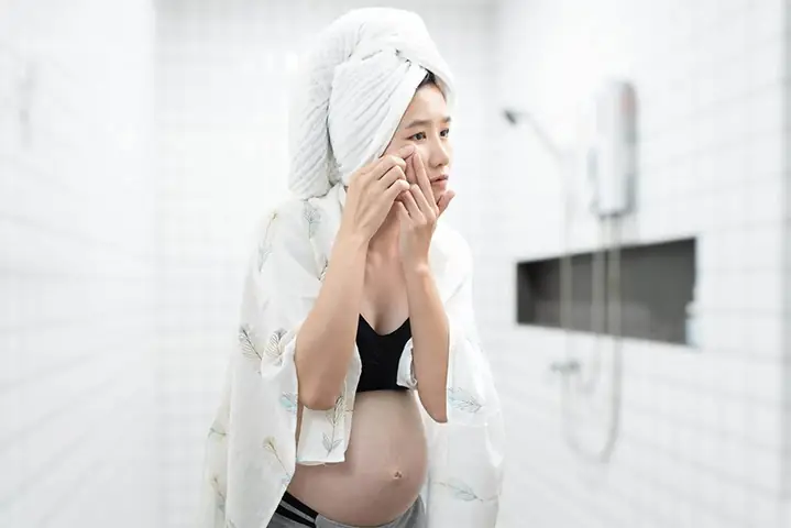 Mang Thai Có Mọc Mụn Không