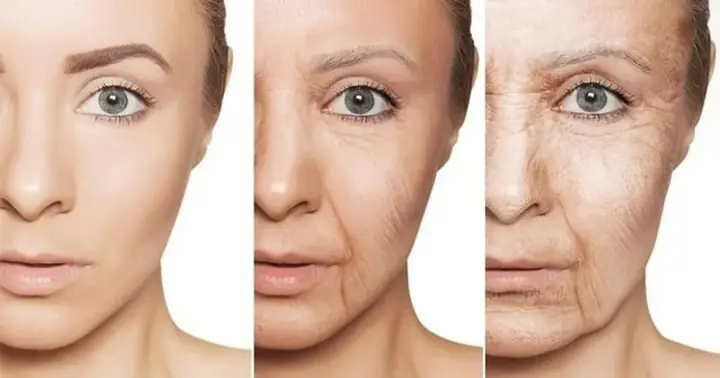 Mặt Bị Chảy Xệ Một Bên