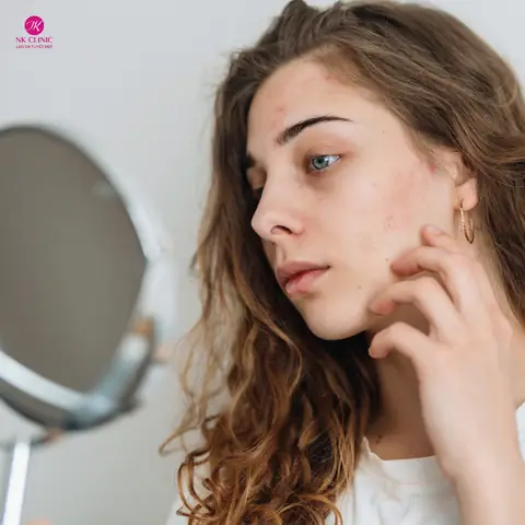 Mặt Bị Chảy Xệ Một Bên