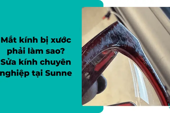 Mắt Kính Bị Xước Phải Làm Sao