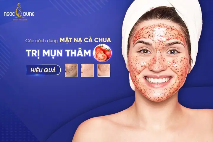 Mặt Nạ Cà Chua Với Muối