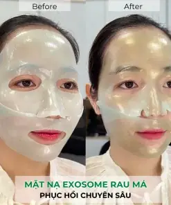 Mặt Nạ Cám Gạo Trứng Gà