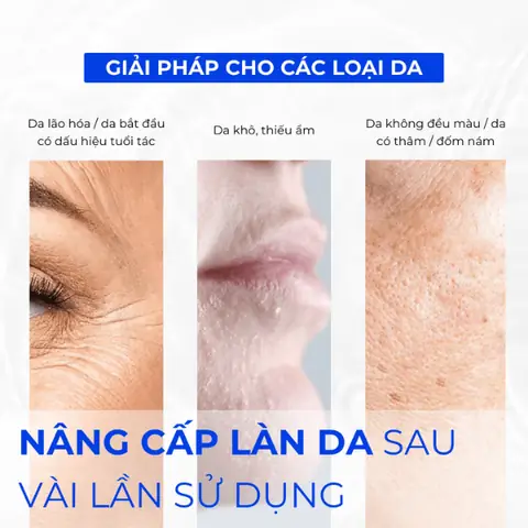 Mặt Nạ Cho Da Khô Và Lão Hóa