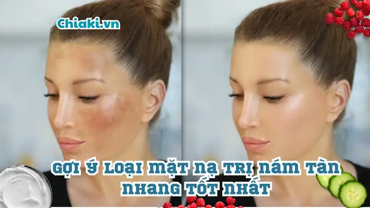 Mặt Nạ Chữa Nám Tàn Nhang