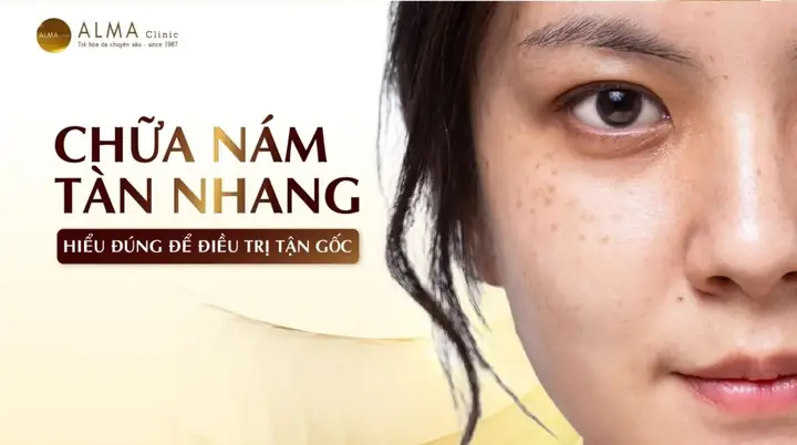 Mặt Nạ Chữa Nám Tàn Nhang