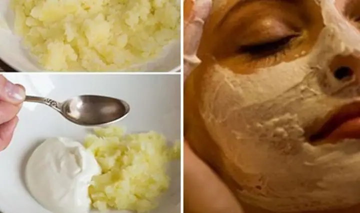 Mặt Nạ Khoai Tây Dầu Dừa