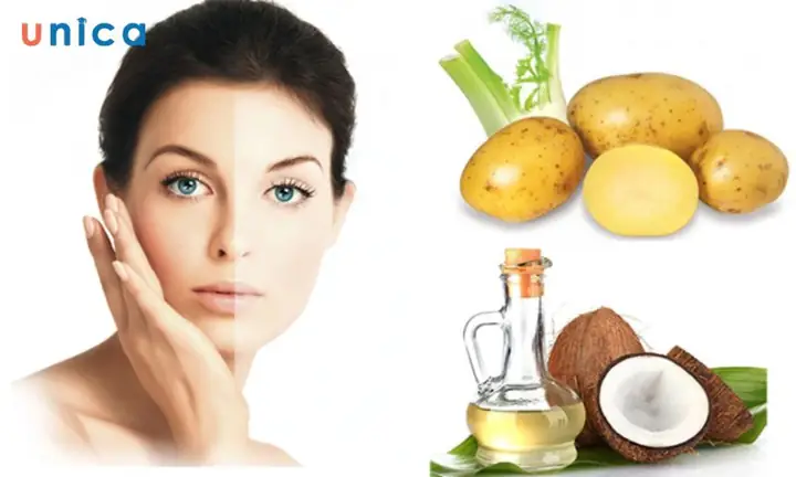 Mặt Nạ Khoai Tây Dầu Dừa Mặt Nạ Khoai Tây Dầu Dừa