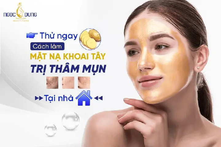Mặt Nạ Khoai Tây Trị Thâm Mụn