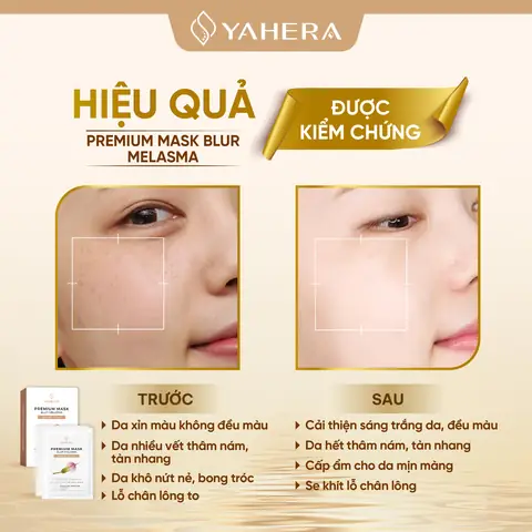 Mặt Nạ Làm Mờ Vết Thâm