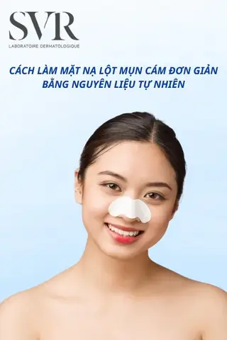Mặt Nạ Lột Mụn Cám Tự Nhiên