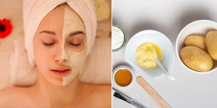 Mặt Nạ Trắng Da Bằng Khoai Tây