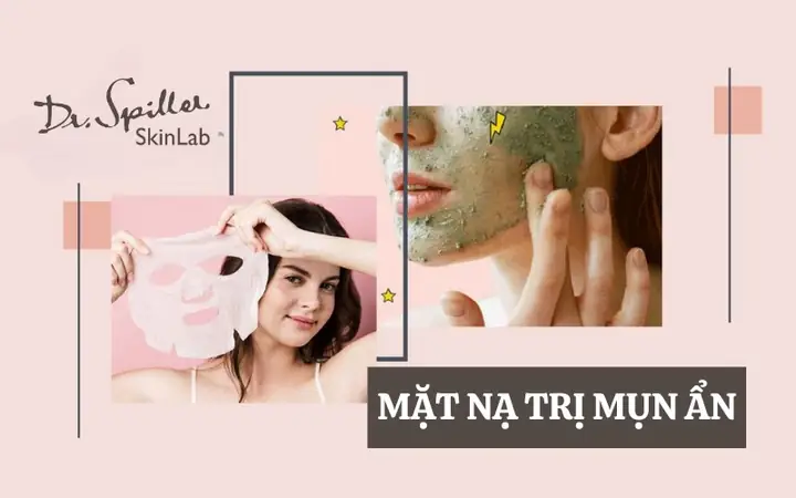 Mặt Nạ Trị Mụn Ẩn Hiệu Quả Mặt Nạ Trị Mụn Ẩn Hiệu Quả