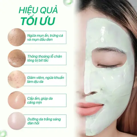 Mặt Nạ Trị Mụn Cho Bà Bầu