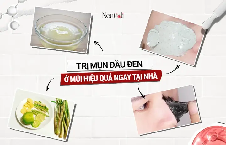Mặt Nạ Trị Mụn Đầu Đen Ở Mũi