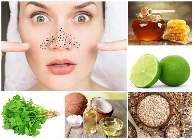 Mặt Nạ Trị Mụn Đầu Đen Ở Mũi