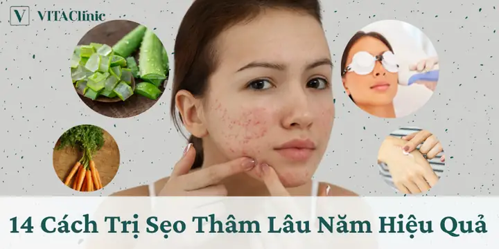 Mặt Nạ Trị Sẹo Rỗ Lâu Năm