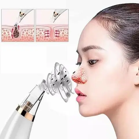 Máy Hút Mụn Có Tốt Không