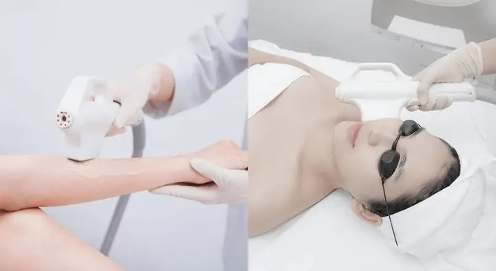 Máy Triệt Lông Công Nghệ Ipl