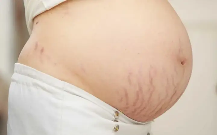 Mẹ Bầu 6 Tháng Nên Làm Gì