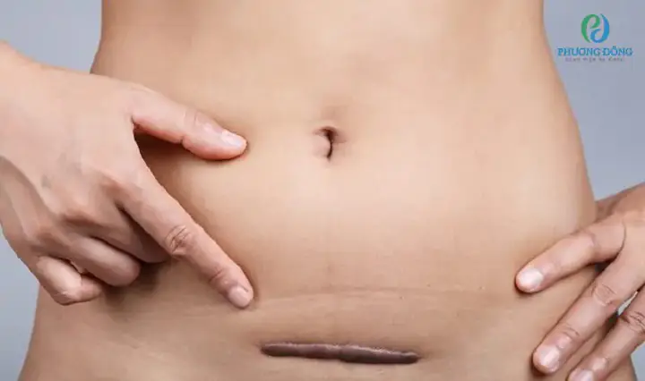Mẹ Mới Sinh Bao Lâu Thì Tắm Được