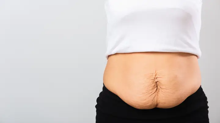 Mẹ Sau Sinh Bị Sổ Bụng