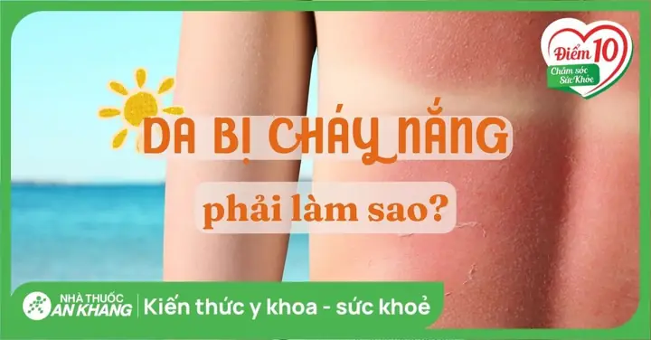 Mẹo Chữa Da Bị Cháy Nắng