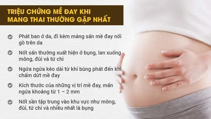 Mẹo Chữa Mề Đay Cho Bà Bầu