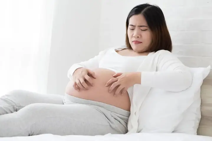 Mẹo Chữa Mề Đay Cho Bà Bầu