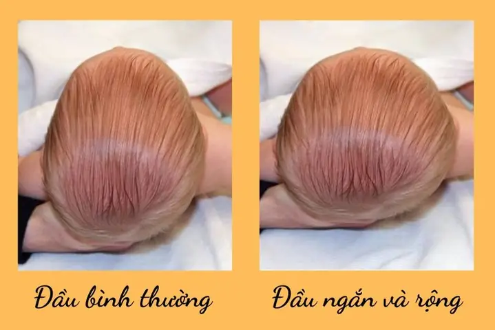 Mẹo Dân Gian Giúp Đầu Bé Tròn