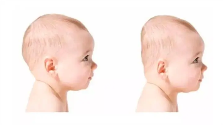 Mẹo Dân Gian Giúp Đầu Bé Tròn