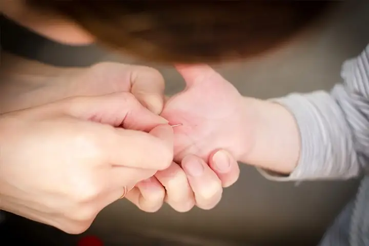 Mẹo Lấy Dằm Đâm Vào Tay Mẹo Lấy Dằm Đâm Vào Tay