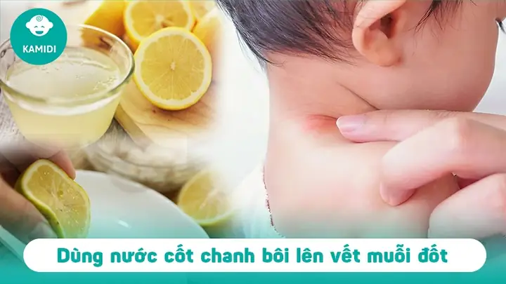 Mẹo Trị Muỗi Đốt Cho Bé