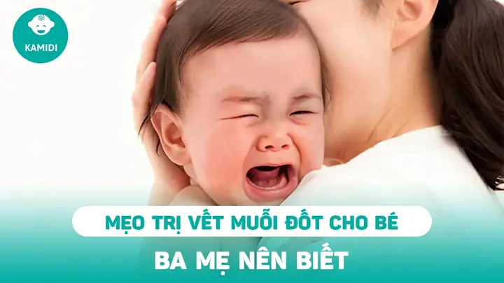 Mẹo Trị Muỗi Đốt Cho Bé