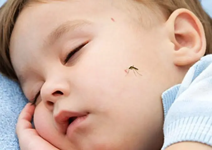 Mẹo Trị Muỗi Đốt Cho Bé
