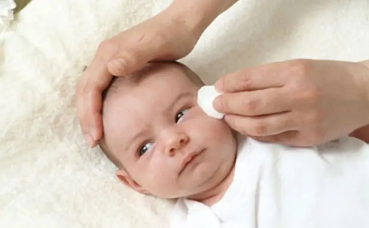 Mí Mắt Trẻ Sơ Sinh Nổi Gân Đỏ