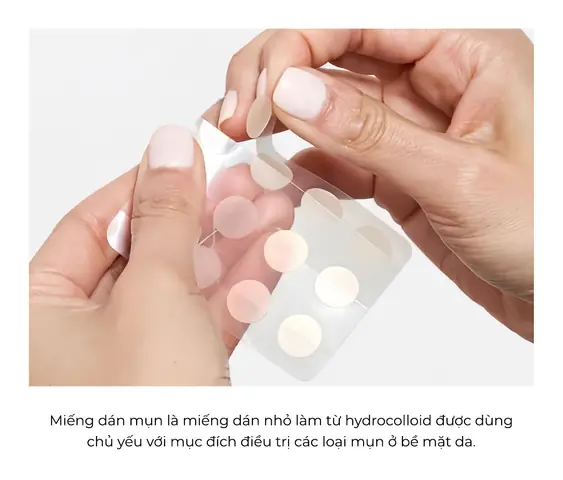 Miếng Dán Trị Mụn Có Tốt Không