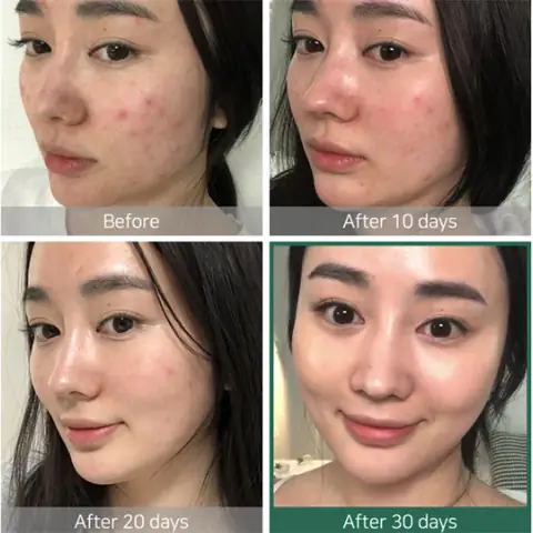 Miracle Toner Some By Mi Review
