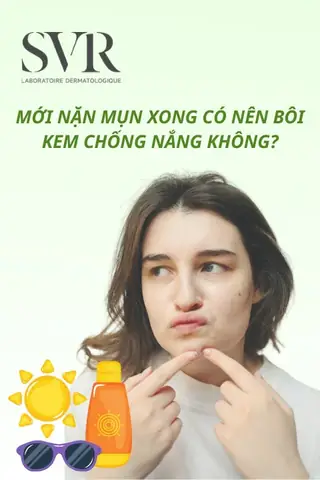 Mới Nặn Mụn Xong Có Nên Bôi Kem Chống Nắng