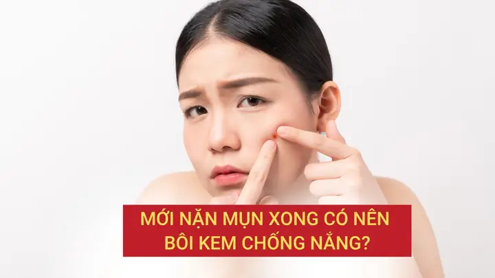 Mới Nặn Mụn Xong Có Nên Bôi Kem Chống Nắng