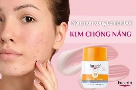 Mới Nặn Mụn Xong Có Nên Bôi Kem Chống Nắng