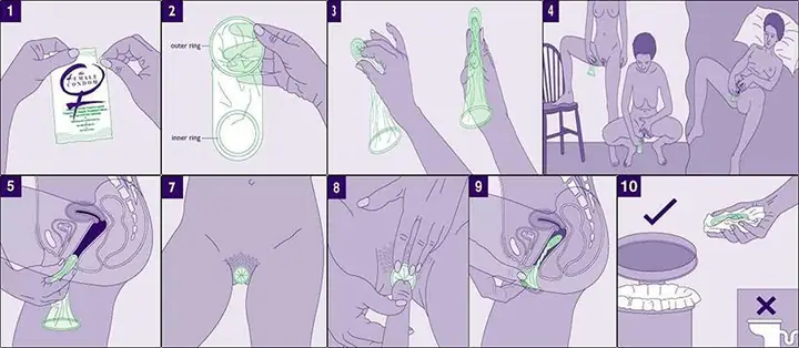 Mua Bao Cao Su Có Gai Ở Đâu
