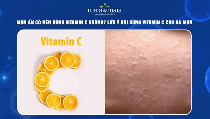 Mụn An Có Nên Dùng Vitamin C Mụn An Có Nên Dùng Vitamin C