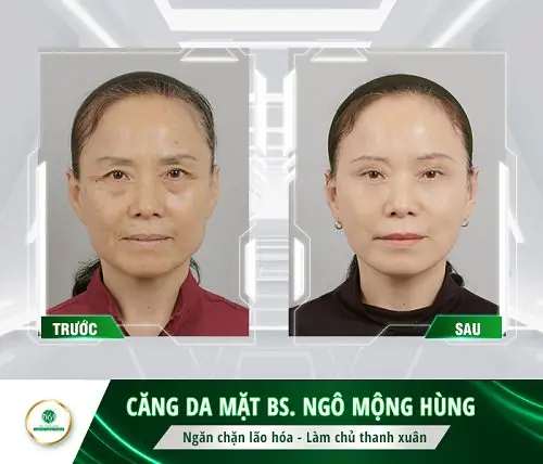 Mỹ Phẩm Làm Căng Da Mặt Cho Nam Mỹ Phẩm Làm Căng Da Mặt Cho Nam