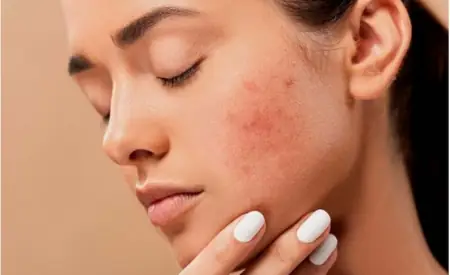 Mỹ Phẩm Tốt Cho Da Nhạy Cảm