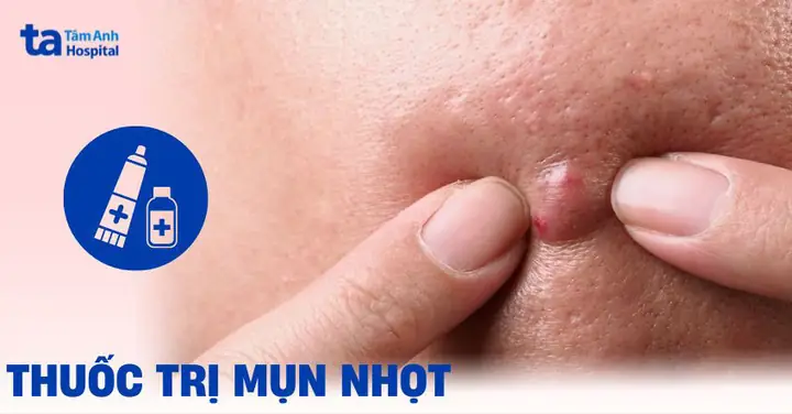 Nên Bôi Thuốc Trị Mụn Khi Nào