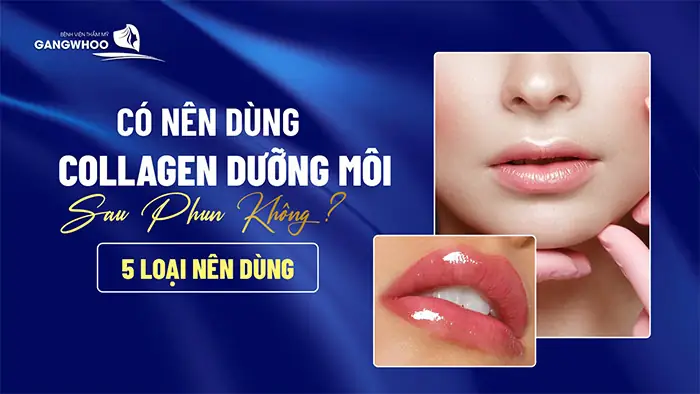Nên Dùng Dưỡng Môi Loại Nào Nên Dùng Dưỡng Môi Loại Nào