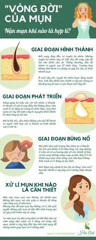 Nên Nặn Mụn Vào Lúc Nào