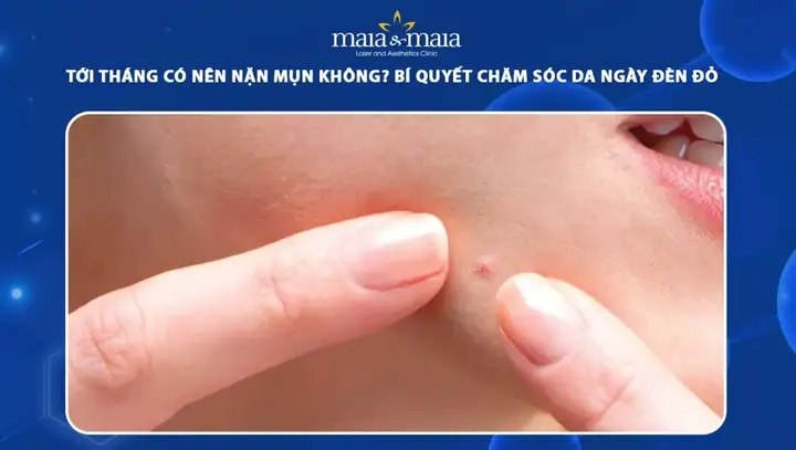 Nên Nặn Mụn Vào Thời Gian Nào Trong Ngày